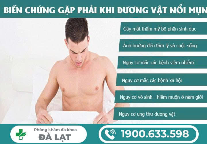 Hình ảnh minh họa